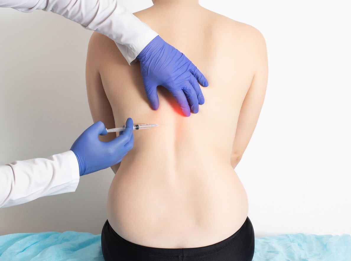 Trattamento di ozonoterapia
